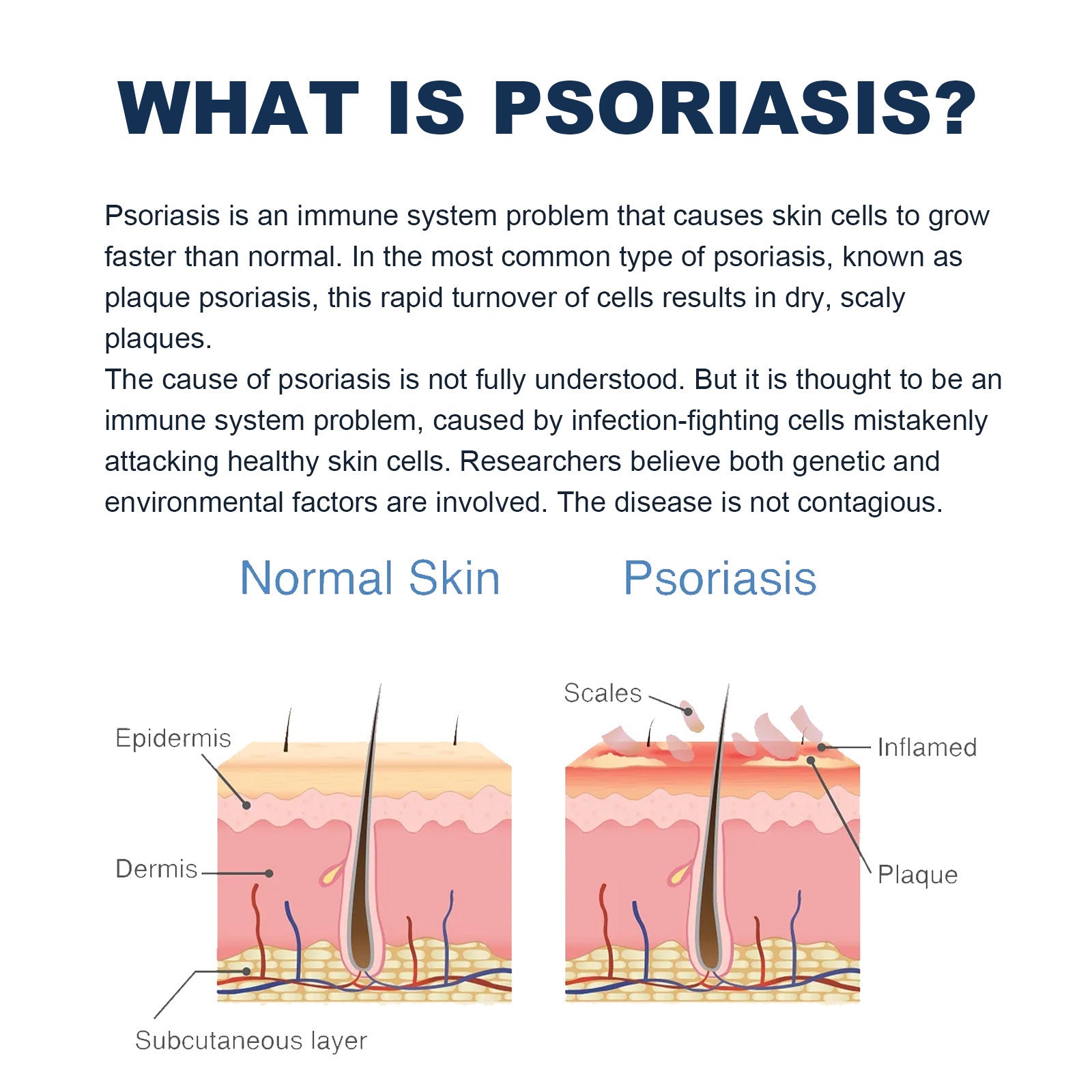 Spray Calmant Psoriasis – Soulagement & Hydratation Instantanés